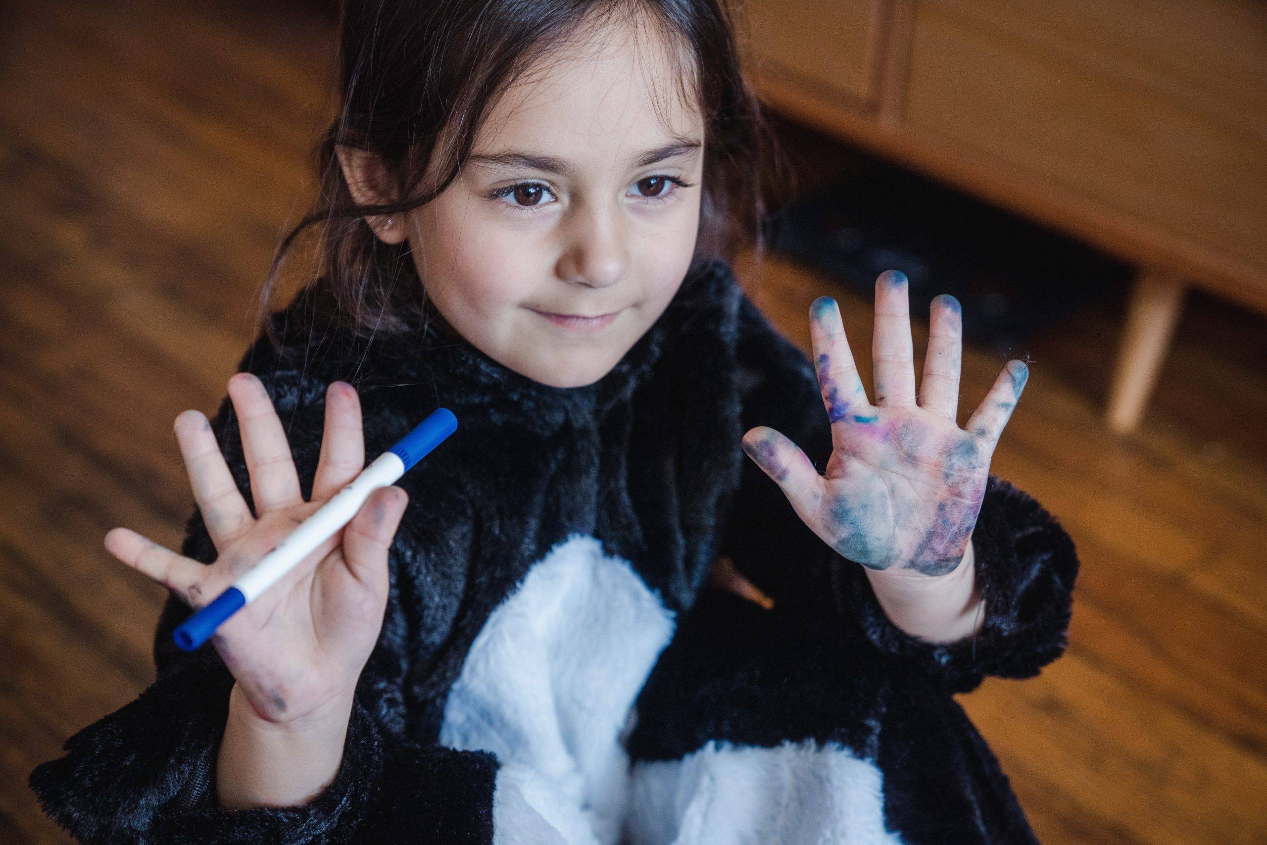 Permanent Marker Stain on Skin [Photo by Liliana Drew]